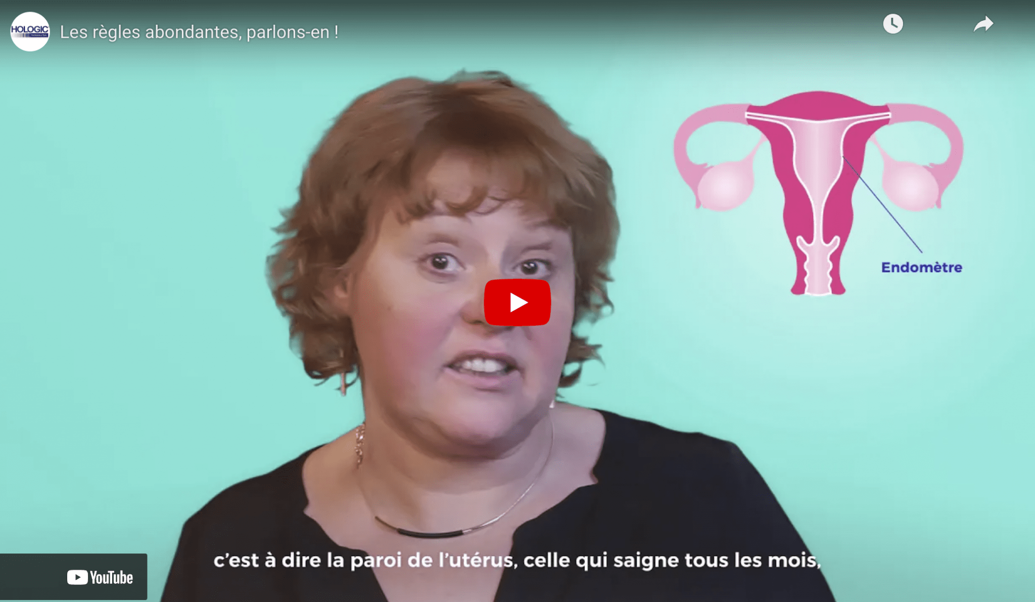 Règles Abondantes – Découvrez si vous avez des règles abondantes et
